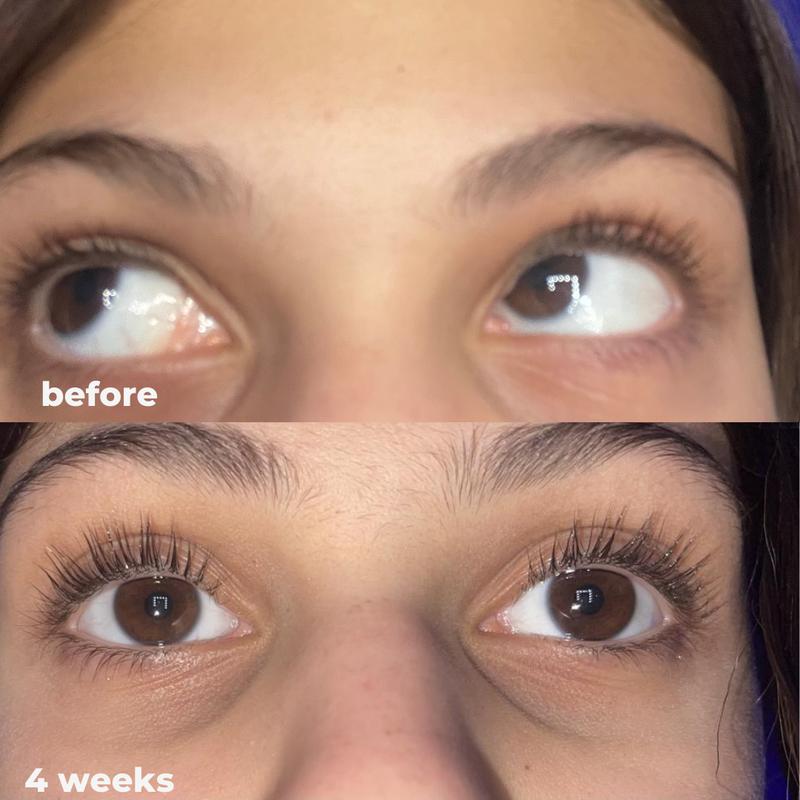 Eyelash Growth Serum