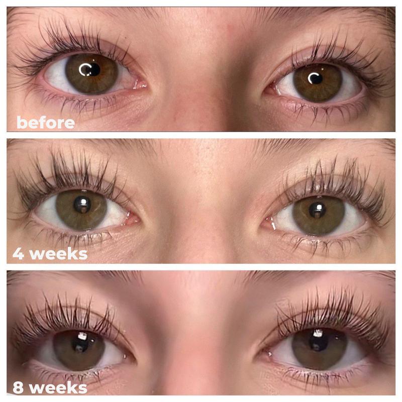 Eyelash Growth Serum